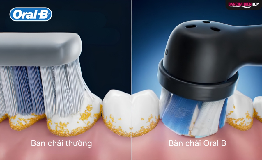 Công Nghệ Vi Rung Và Đầu Chải Tròn Làm Sạch Mảng Bám Hiệu Quả